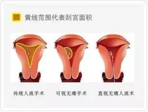 福州福兴妇产医院全新引进宫腔直视吸引手术系统,实现了人流手术