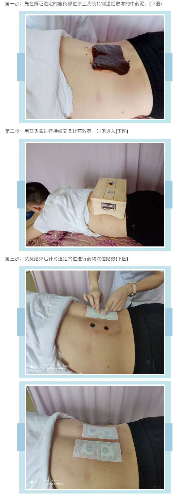强身健体，今年三伏灸预约开始啦_03.jpg